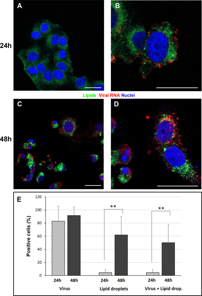 Fig. 4: Confocal microscopy of SARS-CoV-2-infected Vero cells.