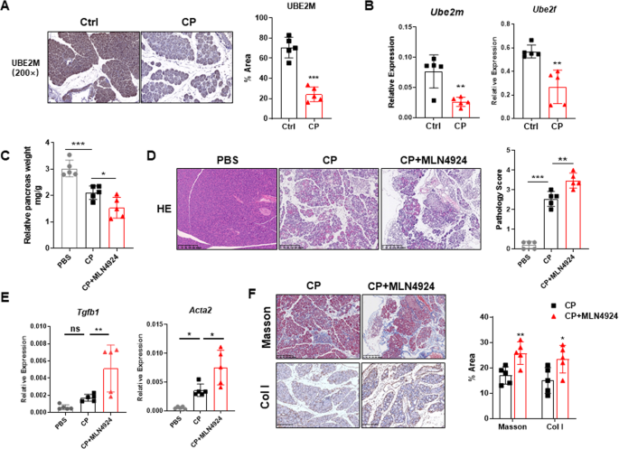 Fig. 1: Neddylation inactivation exacerbates chronic pancreatitis.