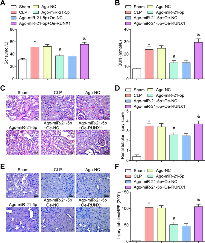 Endothelial Progenitor Cells Derived Exosomal Microrna 21 5p Alleviates Sepsis Induced Acute Kidney Injury By Inhibiting Runx1 Expression Cell Death Disease