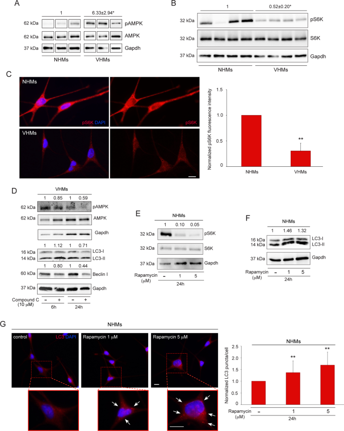 A protective role for autophagy in vitiligo | Cell Death & Disease