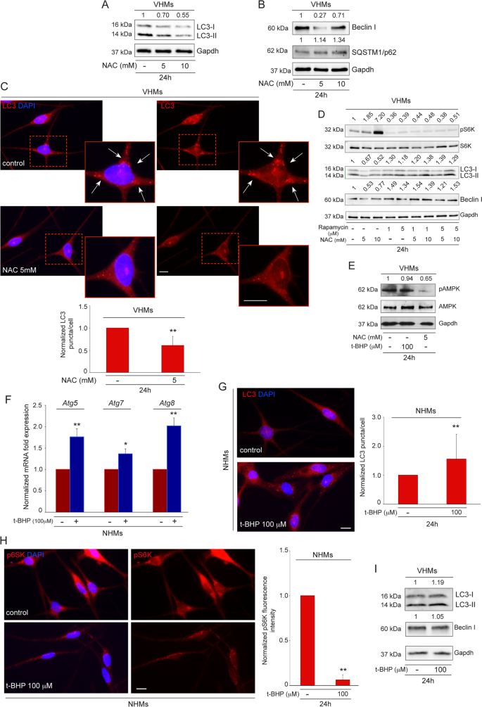 is glutathione good for vitiligo A protective role for autophagy in vitiligo