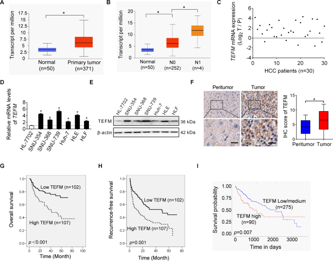 Fig. 1: Up-regulation of TEFM predicts aggressive tumor behavior and poor prognosis of patients with HCC.