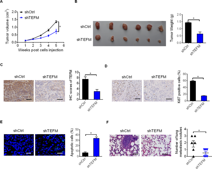 Fig. 4: TEFM knockdown suppressed HCC growth and metastasis in vivo.