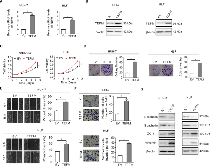 Fig. 5: Over-expression of TEFM increased HCC cell growth and metastasis.