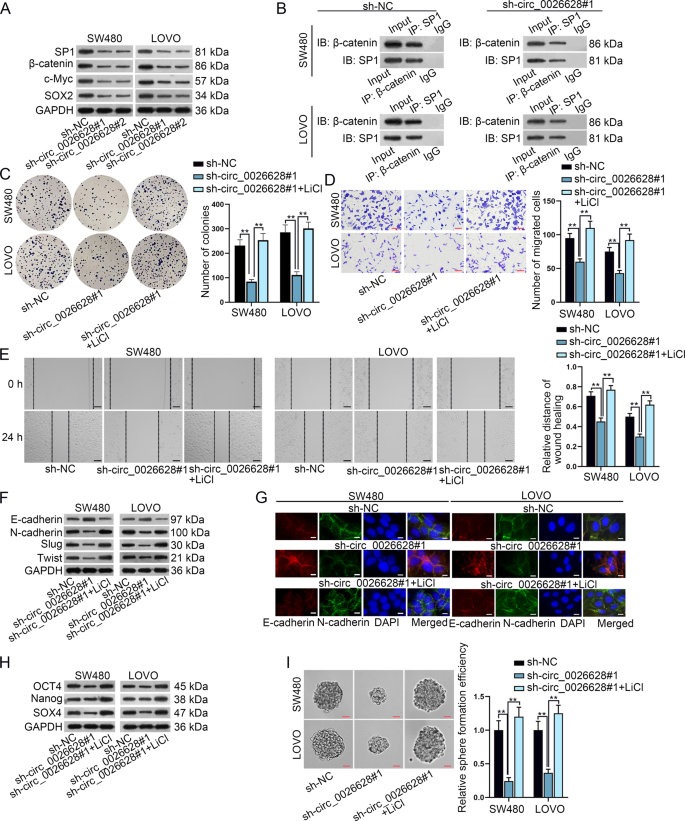 Fig. 6: Circ_0026628 mediated CRC cells via Wnt/β-catenin signaling pathway.