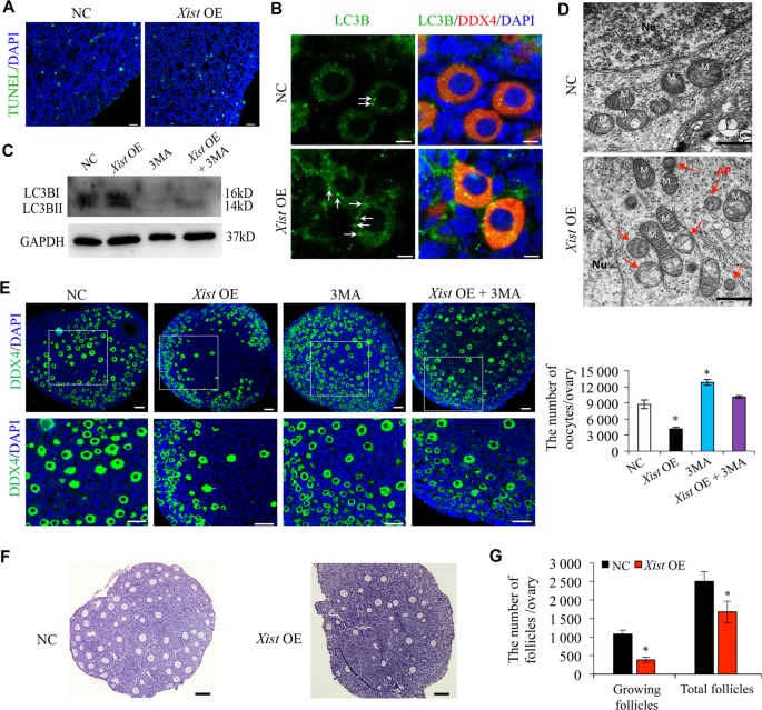 Fig. 2: Xist promotes oocyte autophagy during PF formation.