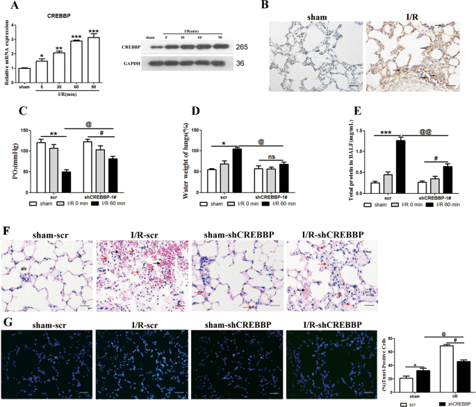 zfp36 protects lungs from intestinal i r induced injury and fibrosis through the crebbp p53 p21 bax pathway cell death disease