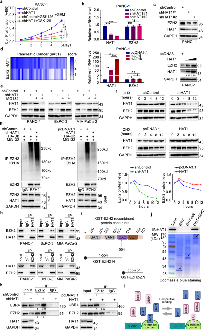Histone acetyltransferase 1 promotes gemcitabine resistance by regulating  the PVT1/EZH2 complex in pancreatic cancer | Cell Death & Disease