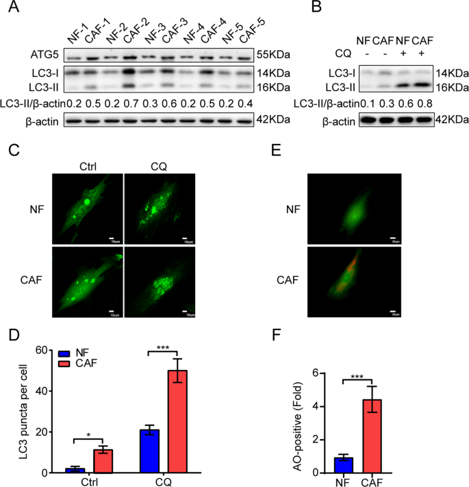 Fig. 1: CAFs of lung cancer possess a high basal level of autophagy.