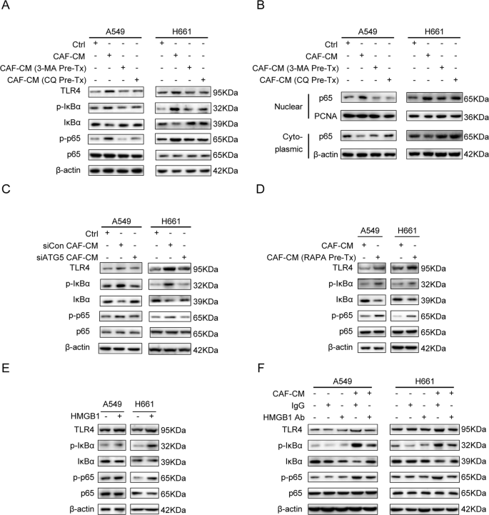 Fig. 7: Autophagy activity is responsible for CAFs’ modulation on TLR4/NF-κB pathway in lung cancer cells via HMGB1 secretion.