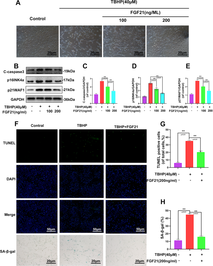 Fig. 1: FGF21 treatment inhibited the apoptosis and senescence of TBHP-induced chondrocytes.