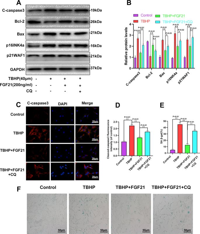 Fig. 4: CQ reversed the effect of FGF21 on the apoptosis and senescence of chondrocytes under oxidative stress.