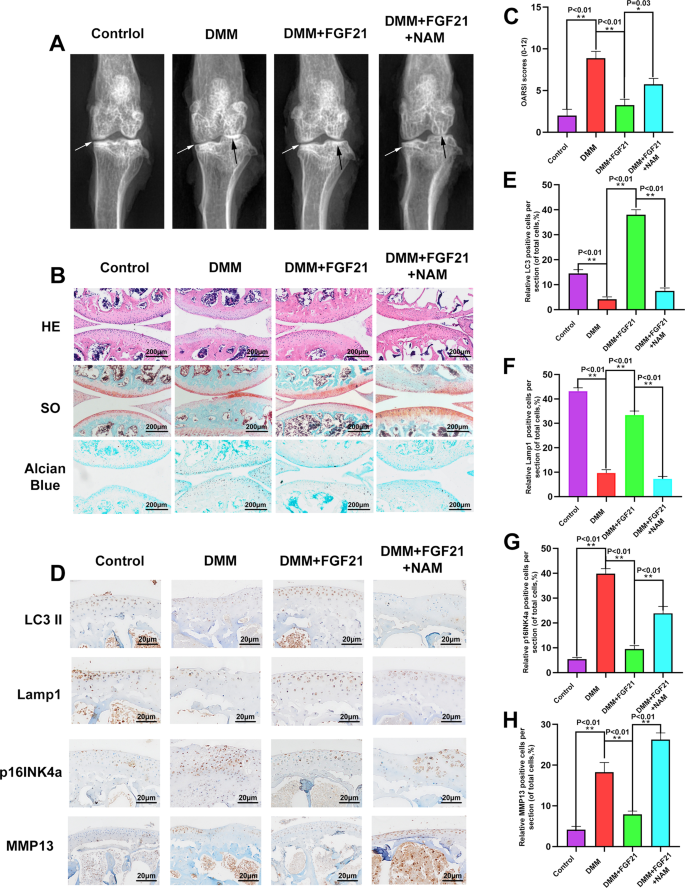 Fig. 8: FGF21 inhibited OA progression in the DMM mouse model via the SIRT1-mTOR signaling pathway.