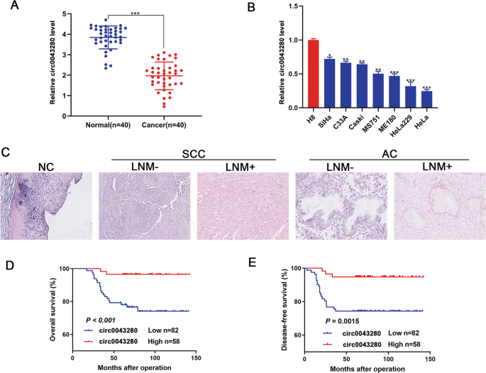 Fig. 2: The downregulated expression of hsa_circ_0043280 was associated with a poor prognosis in patients with CCa.