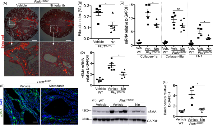 Fig. 3: Nintedanib (Nin) treatment reduced fibrosis in Pkd1RC/RC mice.