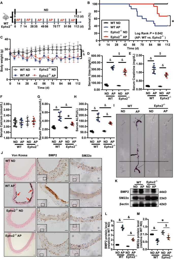 Fig. 1: Deletion of soluble epoxide hydrolase (sEH) inhibited high adenine and phosphate (AP)-induced mouse vascular calcification.