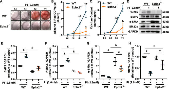 Fig. 2: Deletion of soluble epoxide hydrolase (sEH) ameliorated high phosphate (Pi)-induced vascular smooth muscle cell (VSMC) calcium deposition and phenotypic transition.