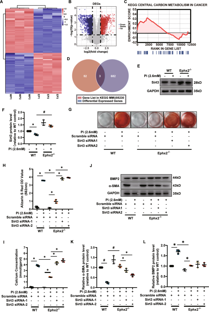 Fig. 3: Sirtuin 3 (Sirt3) was required in the inhibitory effect of soluble epoxide hydrolase (sEH) deletion on calcium deposition in vascular smooth muscle cells (VSMCs).