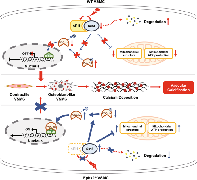 Fig. 6: Schematic cartoon showing the mechanism of soluble epoxide hydrolase (sEH)-related vascular calcification.