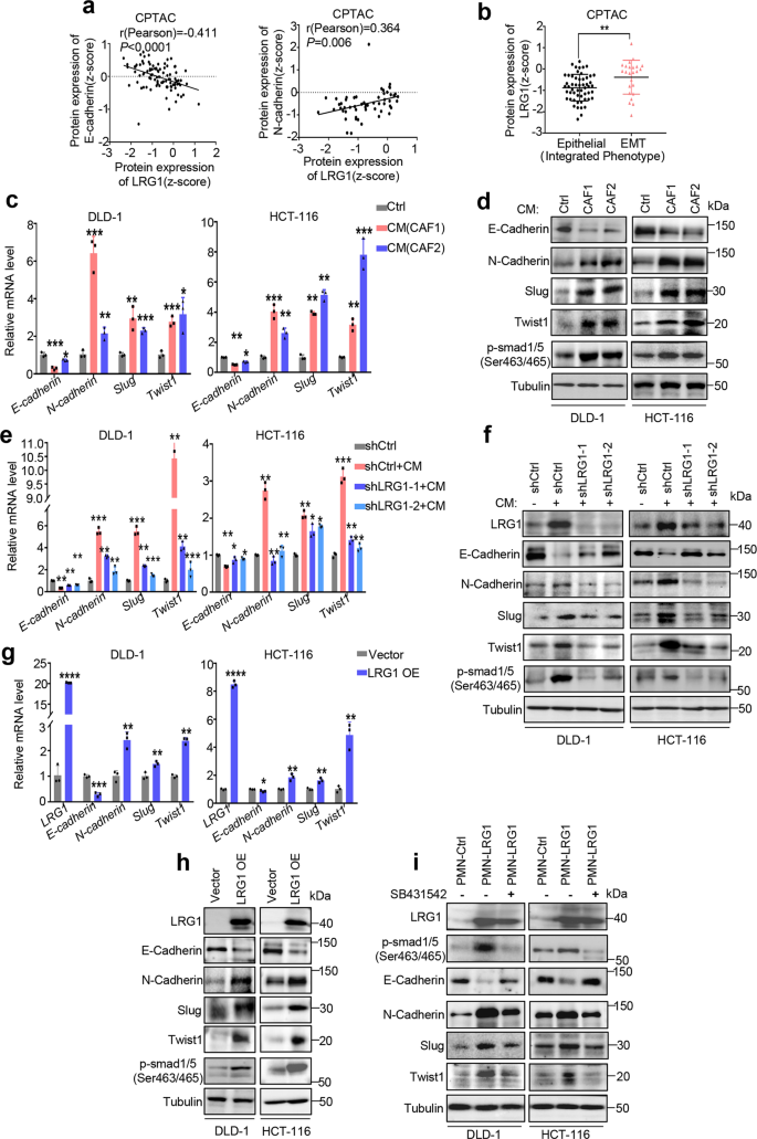 Fig. 3: CAFs-induced LRG1 promotes EMT.
