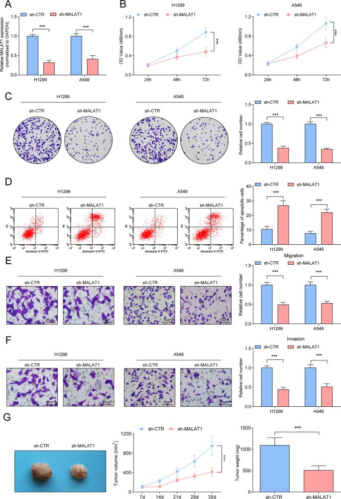 Fig. 3: Inhibitory effects of down-regulated MALAT1 on NSCLC.