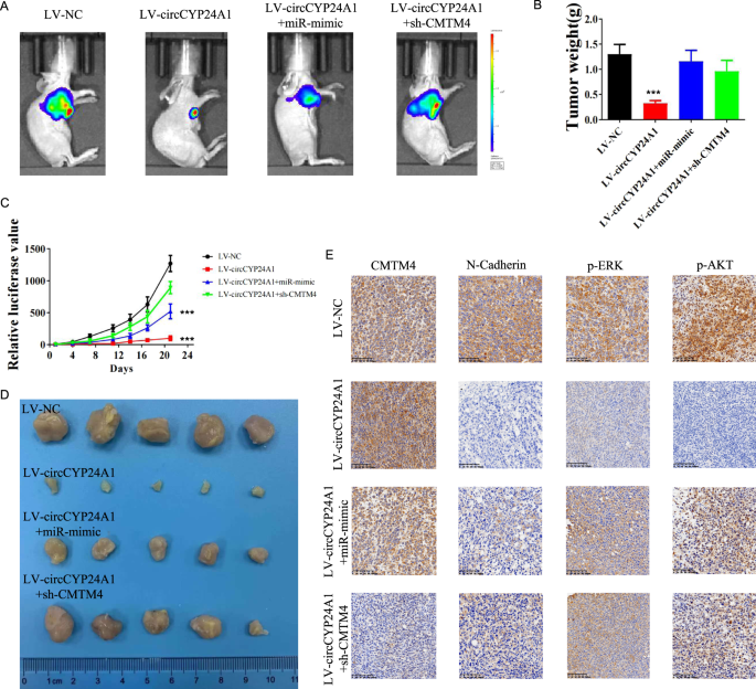 Fig. 7: Overexpression of circCYP24A1 suppresses RCC progression in vivo.