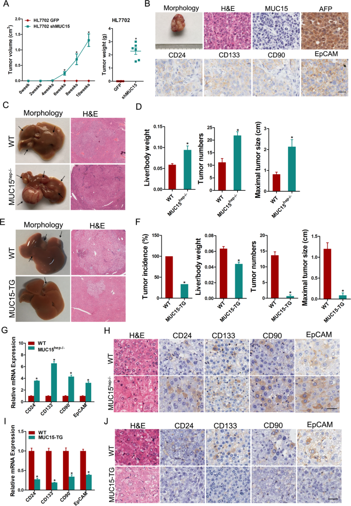 Fig. 1: MUC15 suppresses hepatocellular oncogenesis via inhibiting T-ICs generation.