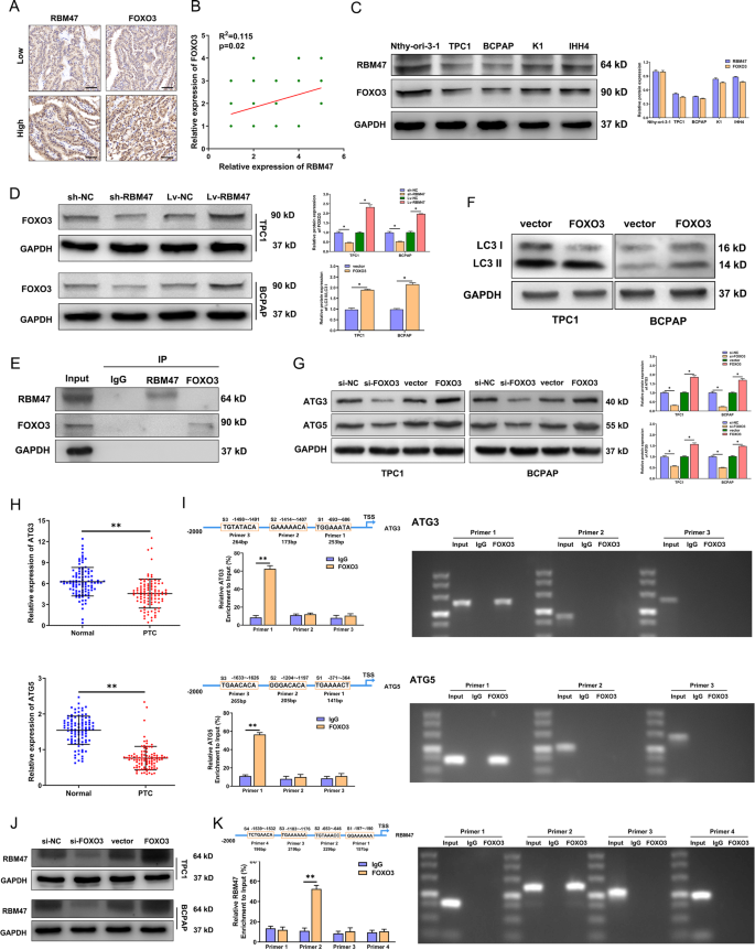 Fig. 2: RBM47 activates autophagy by regulating FOXO3.
