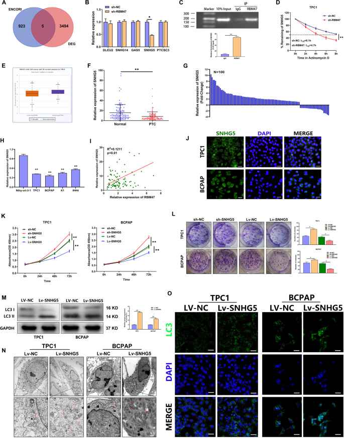 Fig. 3: RBM47 stabilized SNHG5 to inhibit proliferation and activate autophagy in PTC cells.