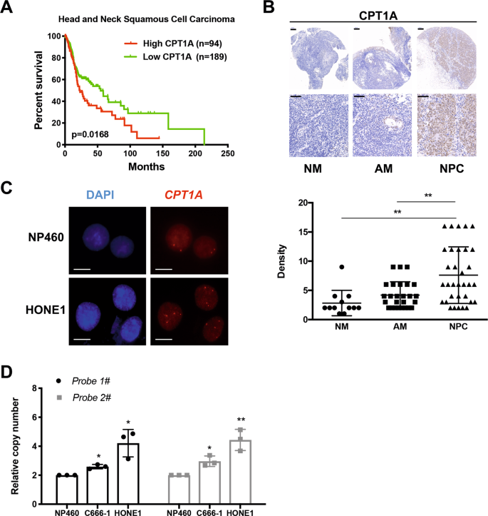 A) Thigh muscle Ucp3, (B) Cpt1b, and (C) Slc2a4 mRNA expression in