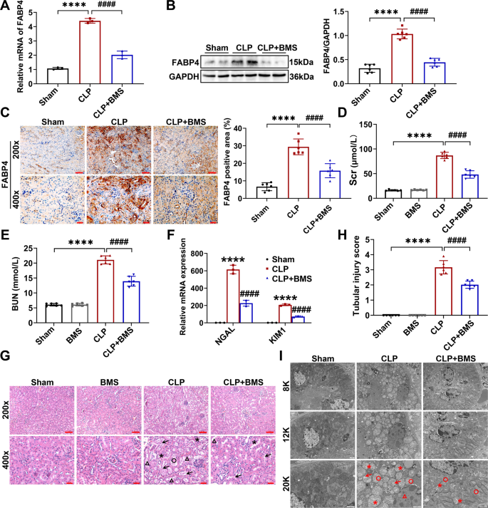 Fig. 2: FABP4 inhibitor BMS309403 treatment alleviated CLP-induced septic AKI in mice.
