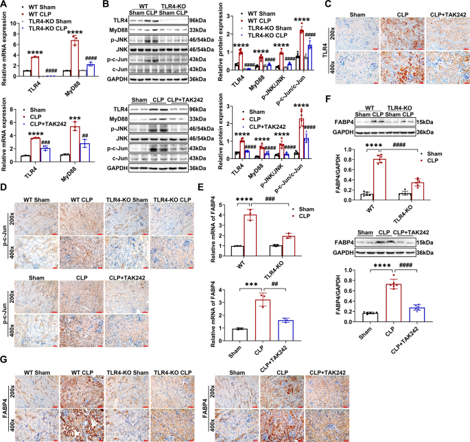 Fig. 4: CLP-induced upregulation of FABP4 was mediated by TLR4 signaling in injured kidneys.