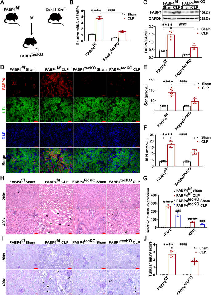 Fig. 9: Renal tubular epithelial cell-specific (RTEC-specific) deletion of FABP4 attenuated CLP-induced septic AKI in mice.