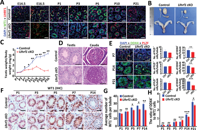 Fig. 2: Conditional inactivation of Uhrf1 in SCs results in spermatogenic arrest and male infertility in mice.