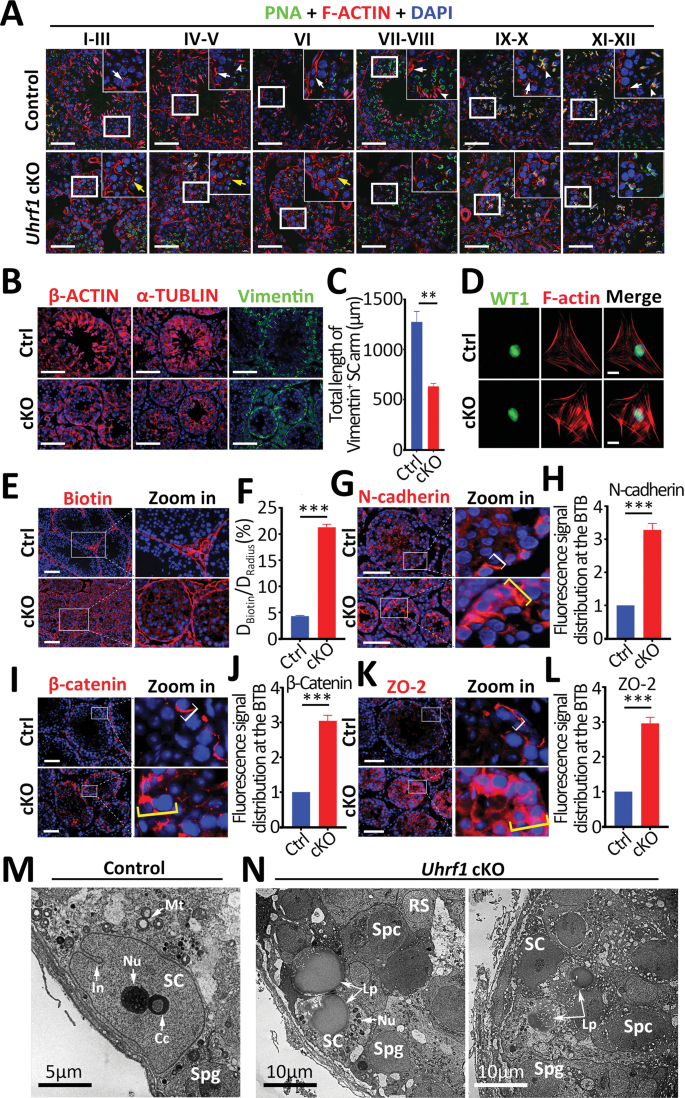 Fig. 4: Ablation UHRF1 in SCs results in disorganization of SC actin cytoskeleton and severe disruption of the BTB.