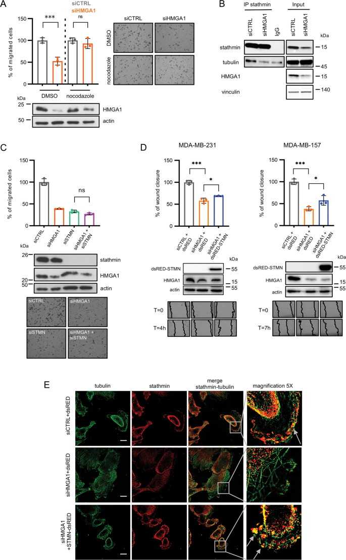 HMGA1 positively regulates the microtubule-destabilizing protein stathmin promoting motility in TNBC cells and decreasing tumour sensitivity to paclitaxel | Cell Death & Disease hmga1-positively-regulates-the-microtubule-destabilizing-protein-stathmin-promoting-motility-in-tnbc-cells-and-decreasing-tumour-sensitivity-to-paclitaxel-cell-death-disease