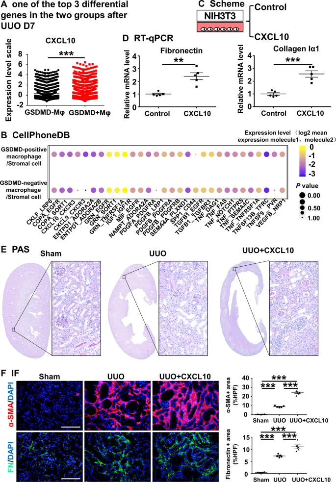Fig. 8: CXCL10 can aggravate the progression of obstructive nephropathy.