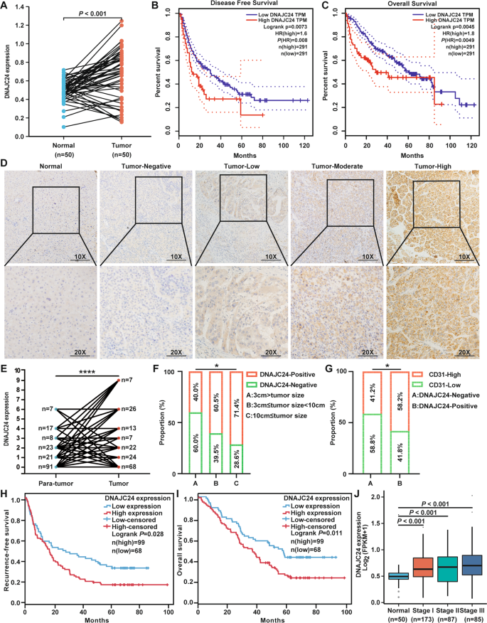 Fig. 1: DNAJC24 expression is generally upregulated in human HCC tissues and is associated with poor patient prognosis.