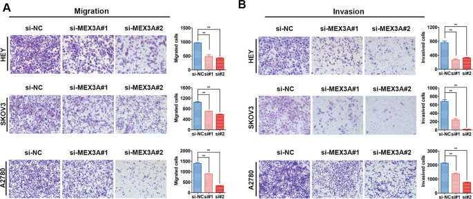 Fig. 3: MEX3A downregulating suppresses the metastasis of ovarian cancer cells.