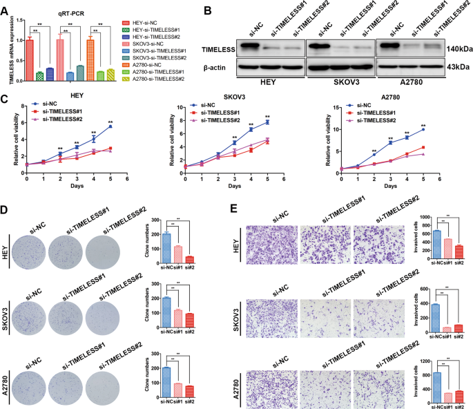 Fig. 5: TIMELESS mediates the growth and metastasis of ovarian cancer cells.