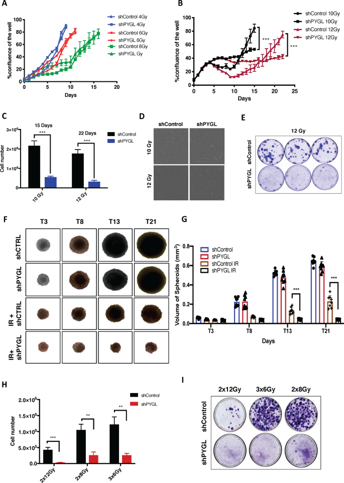 Fig. 2: Inhibition of glycogen phosphorylase liver isoform (PYGL) sensitises glioblastoma (GBM) cells to ionising radiation (IR).