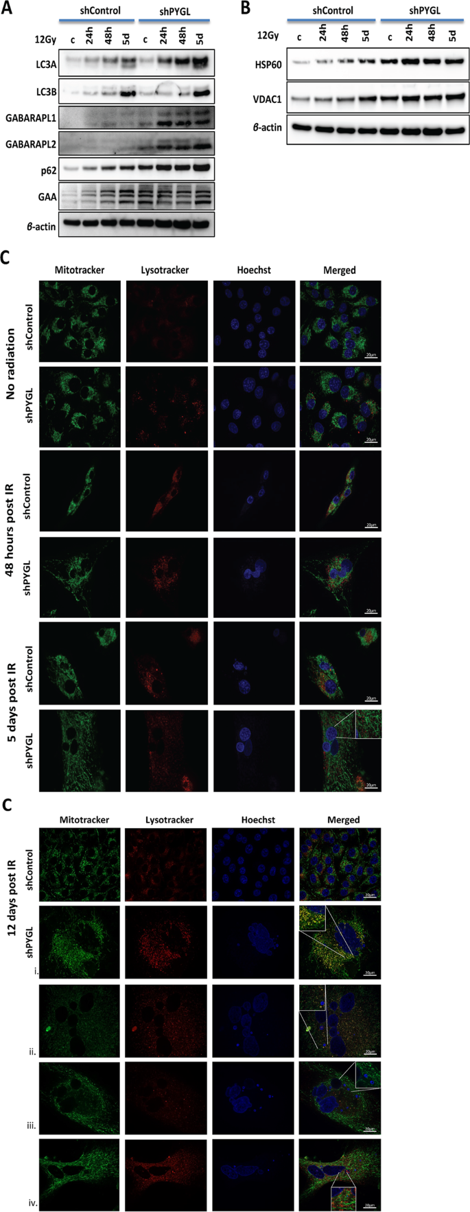 Fig. 4: Inhibition of glycogen phosphorylase liver isoform (PYGL) induces dysfunction of autophagy and alters the morphology of mitochondria following ionising radiation (IR).