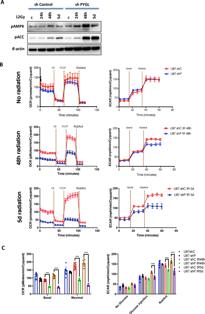 Fig. 5: Inhibition of glycogen phosphorylase liver isoform (PYGL) alters the metabolic profile of glioblastoma (GBM) cell lines in response to ionising radiation (IR).