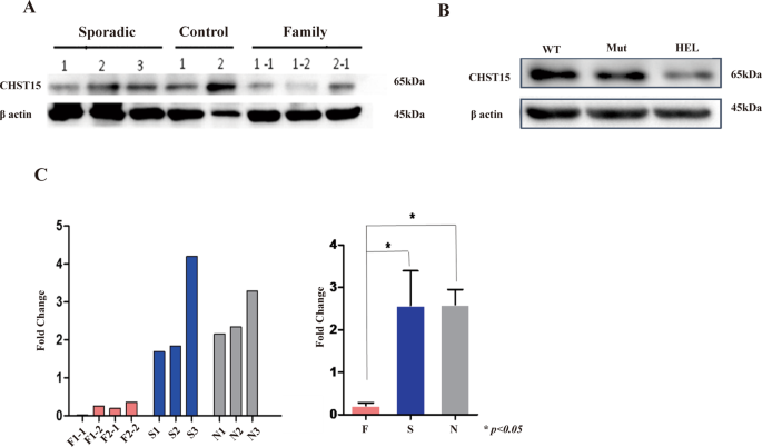 Fig. 4: CHST15 protein and mRNA expression in familial MPN patients and HEL cells with CHST15 mutant (Western blot results).