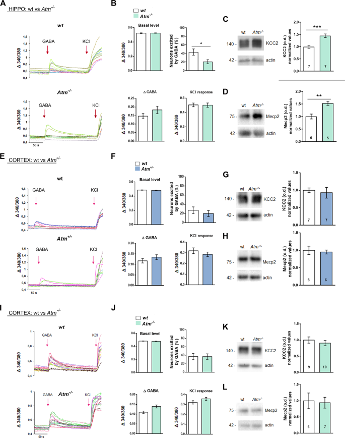 Fig. 2: ATM does not control the excitatory-to-inhibitory GABA switch in cortical neurons.