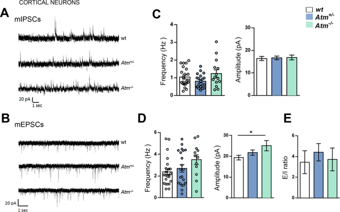 Fig. 3: ATM deficiency affects basal synaptic transmission in hippocampal but not in cortical neurons.