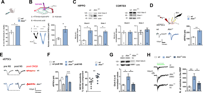 Fig. 4: ATM heterozygosity leads to increased levels of functional kainate receptors which are responsible for higher glutamatergic response and bigger size of RRP.