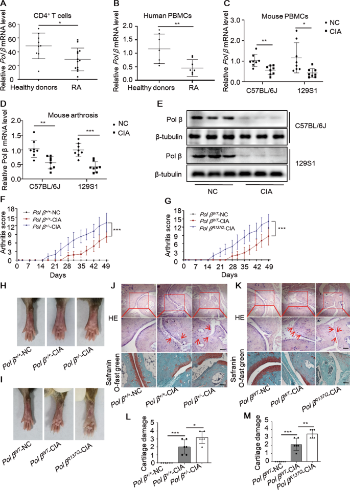 A novel mechanism for macrophage pyroptosis in rheumatoid arthritis induced  by Pol β deficiency | Cell Death & Disease