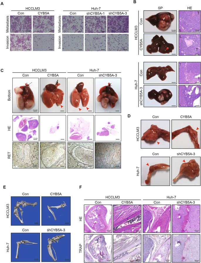 Fig. 2: CYB5A inhibits metastasis of HCC.