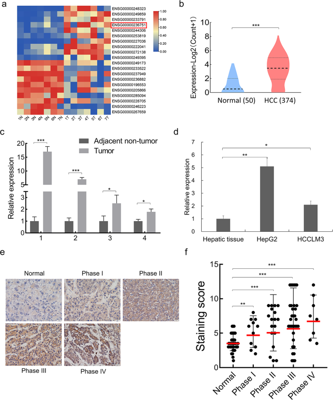 Fig. 1: SALIS is higher-expressed in HCC tumors and cells.